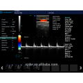 DW-C80 todo o varredor do ultra-som de Doppler da cor de Digitas